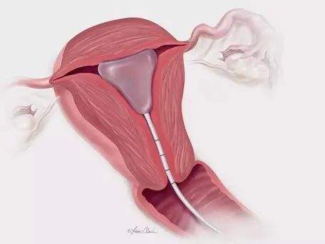 盛京试管三代怎么样啊_沈阳盛京医院三代试管多少钱